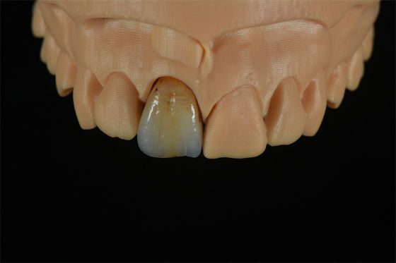 品質  Affordable Zirconia Crowns with Custom Color Staining - China Dental Lab 工場